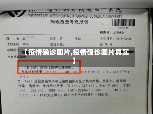 【疫情确诊图片,疫情确诊图片真实】